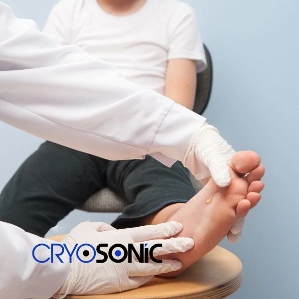 Are you looking for fast effective wart removal Contact us today Wembley